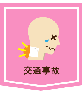 交通事故